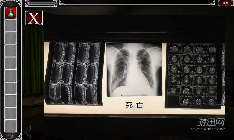 中古疯人院截图5